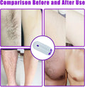 FINISHING TOUCH Instant Pain Free Hair Remover - PERFECTCART.STORE
