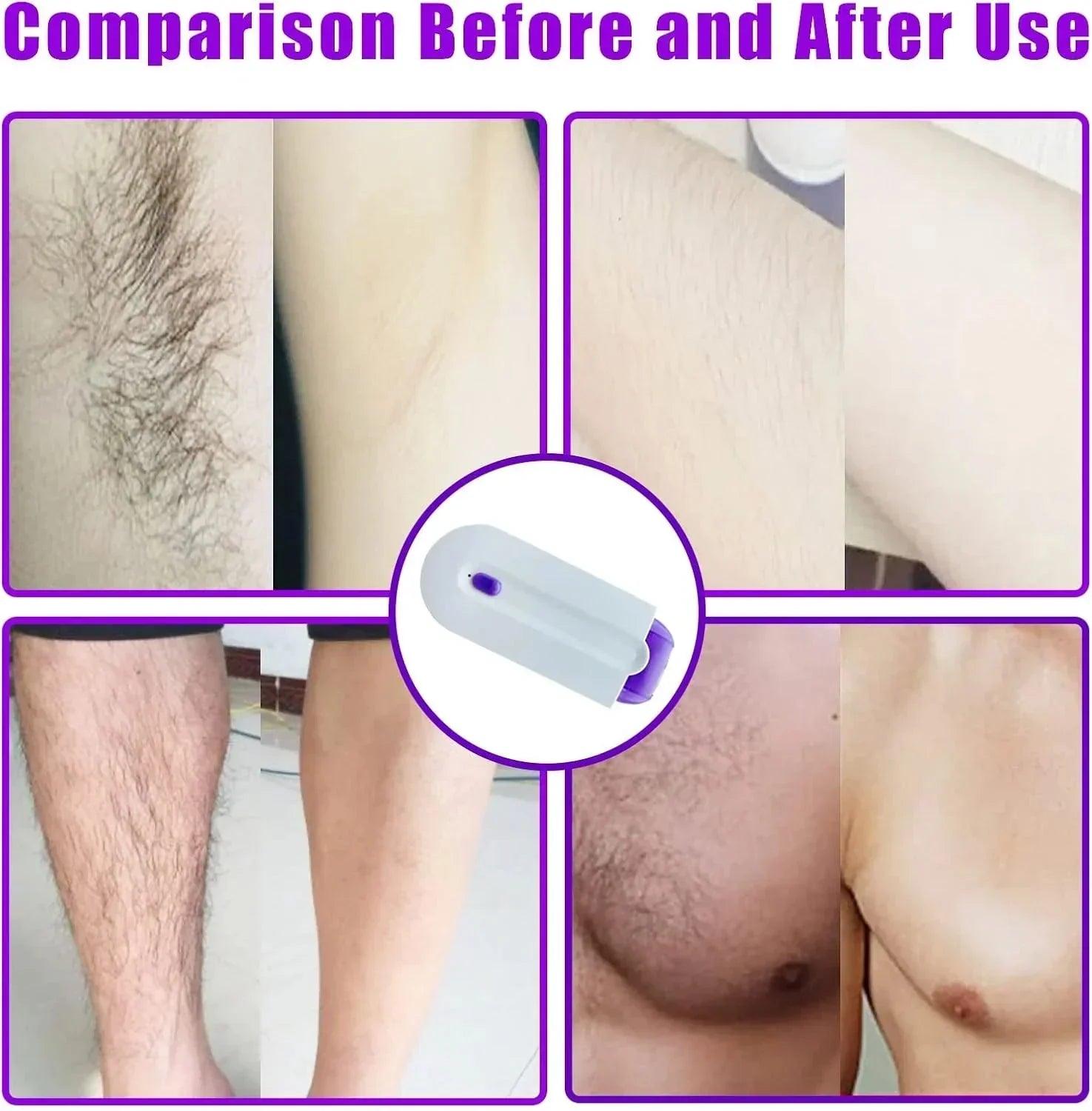 FINISHING TOUCH Instant Pain Free Hair Remover - PERFECTCART.STORE